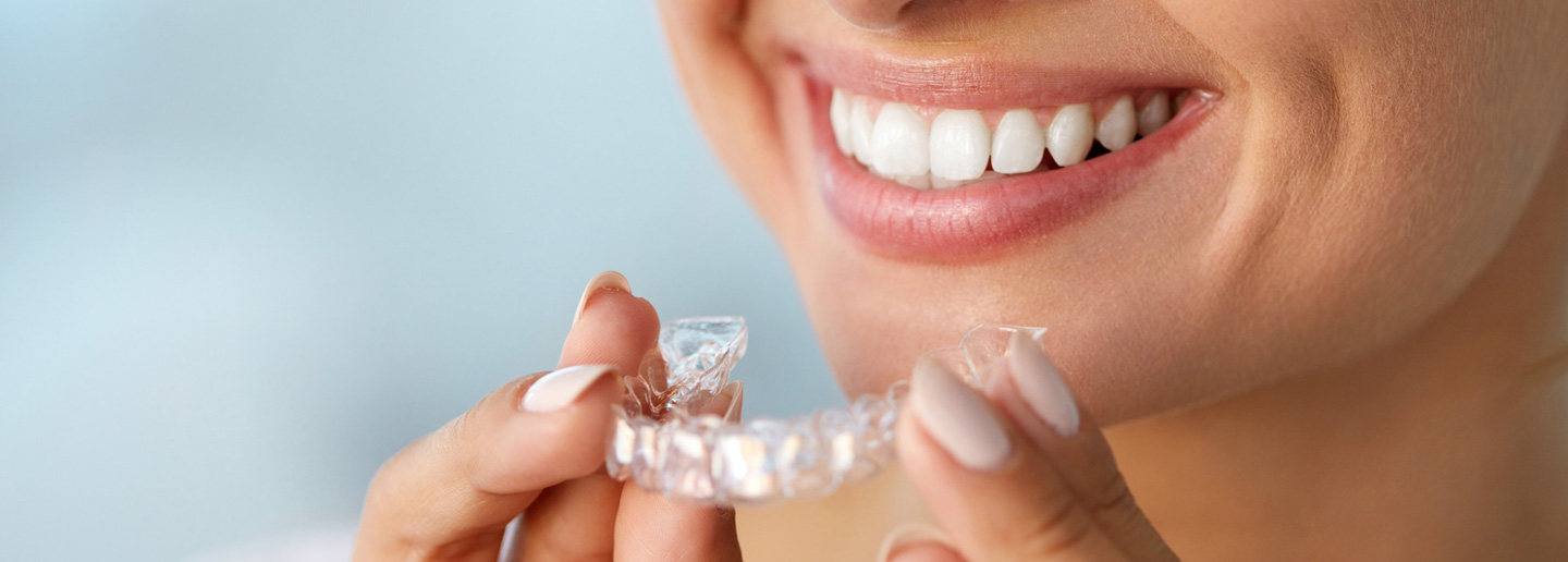 Fast unsichtbare Zahnspange bei Ihrem Zahnarzt in Rosenheim: Kieferorthopädie mit Invisalign®