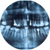 Spezialisierter Zahnarzt für Wurzelbehandlung in Rosenheim-Happing: Zahnarzt Dr. Schmid